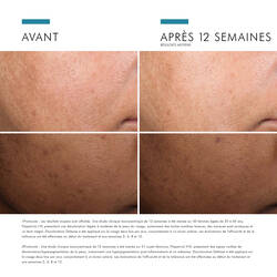 Discoloration Defense