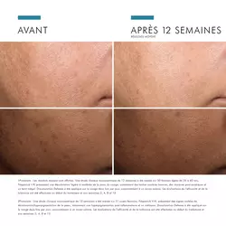 Discoloration Defense
