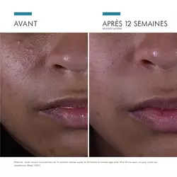 Silymarin CF