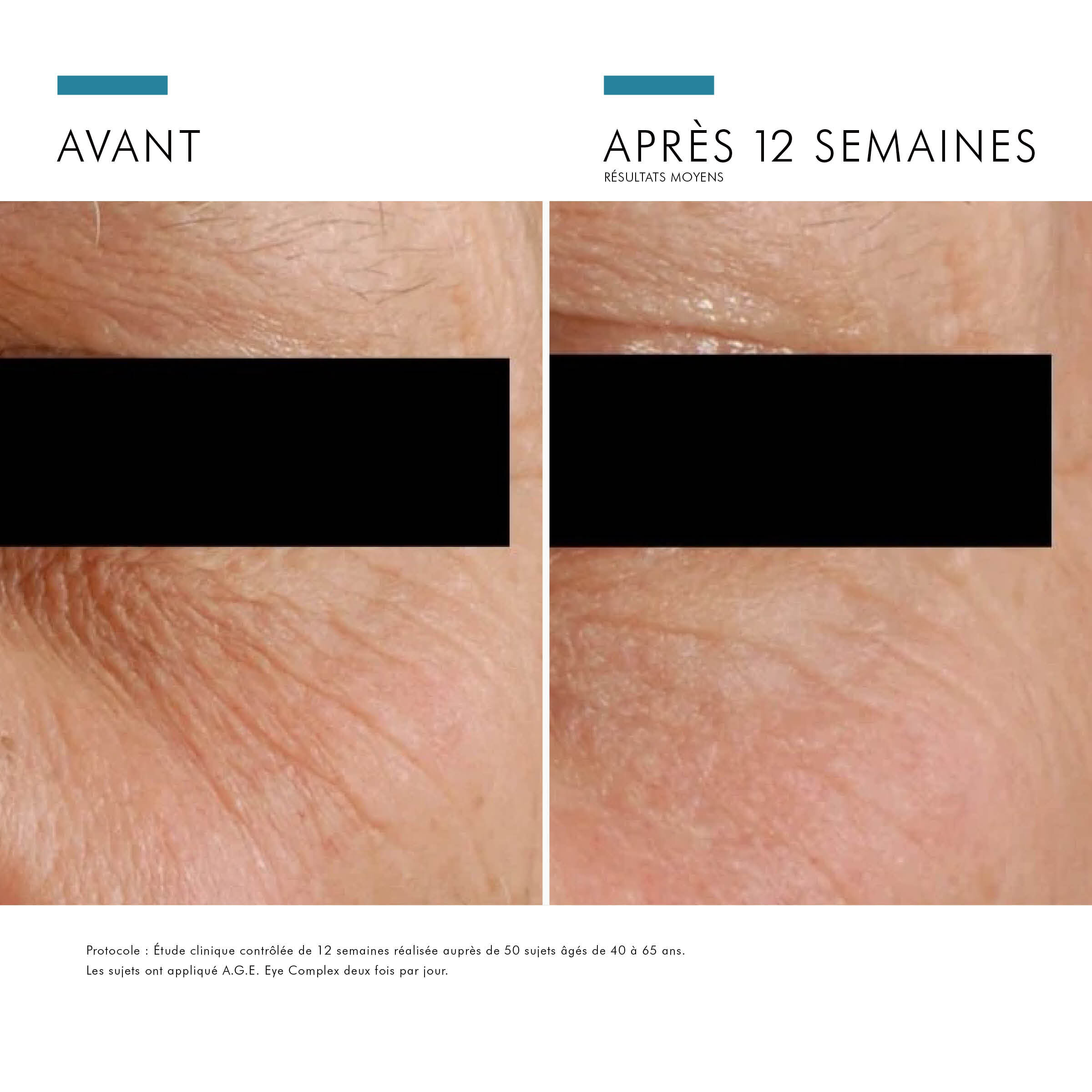 A.G.E. EYE COMPLEX FOR DARK CIRCLES
