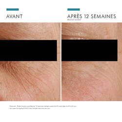 A.G.E. EYE COMPLEX FOR DARK CIRCLES