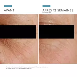 A.G.E. EYE COMPLEX FOR DARK CIRCLES