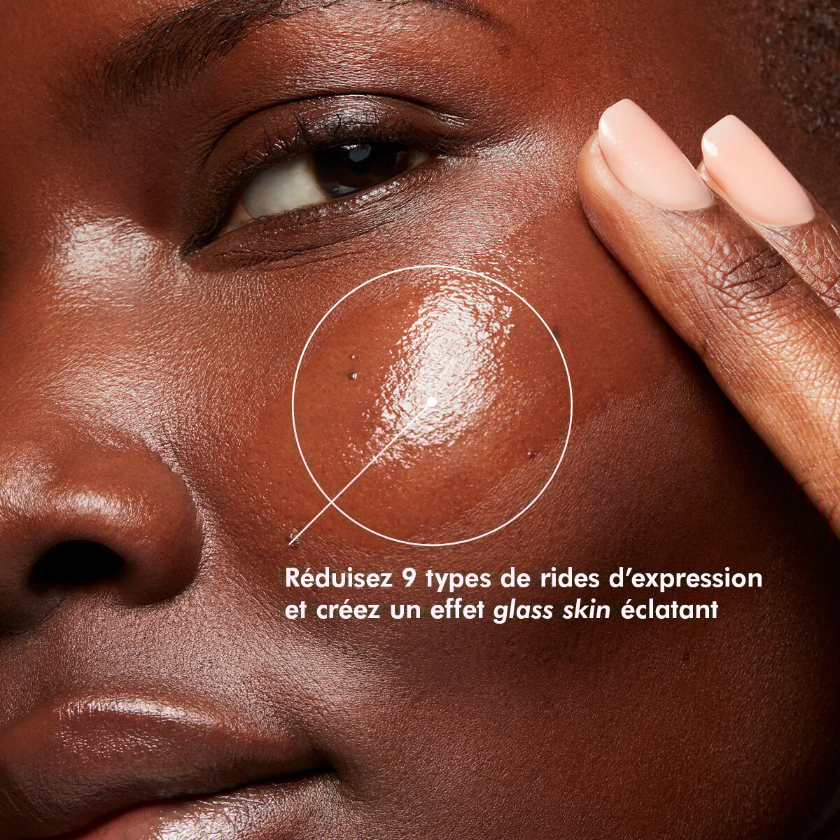 Reduire 9 types de rides d'expression