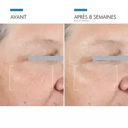 A.G.E. Advanced Eye creme anti-cernes et rides