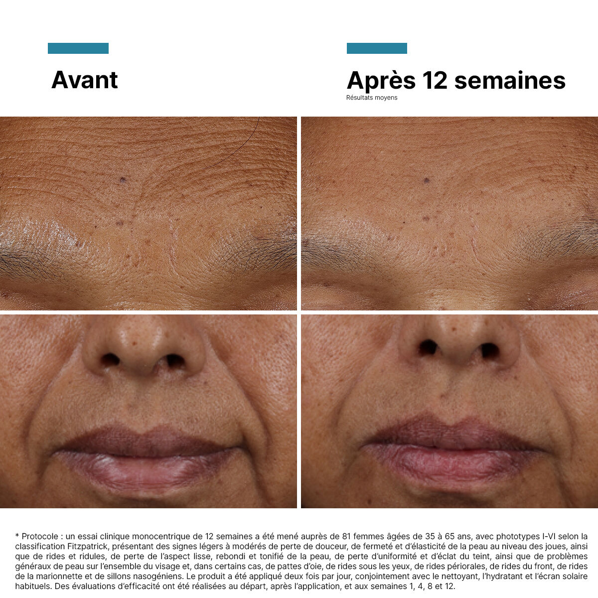 HA Intensifier Multi-Glycan