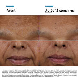 HA Intensifier Multi-Glycan