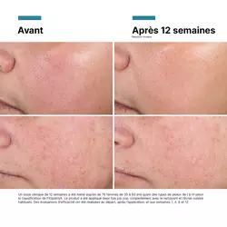 Advanced RGN-6 Creme pour le visage
