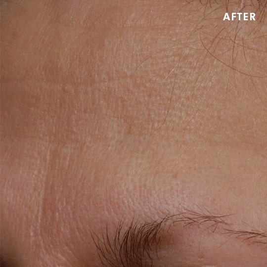 Skinceuticals Canada Science and Proof