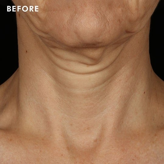 Skinceuticals Canada Before