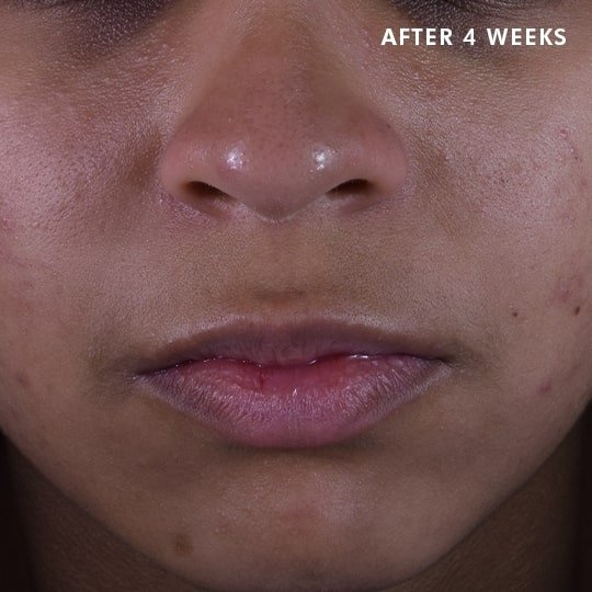Skinceuticals Canada After